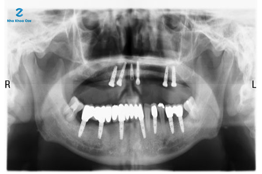 Giúp tìm ra những vấn đề răng miệng từ sâu bên trong