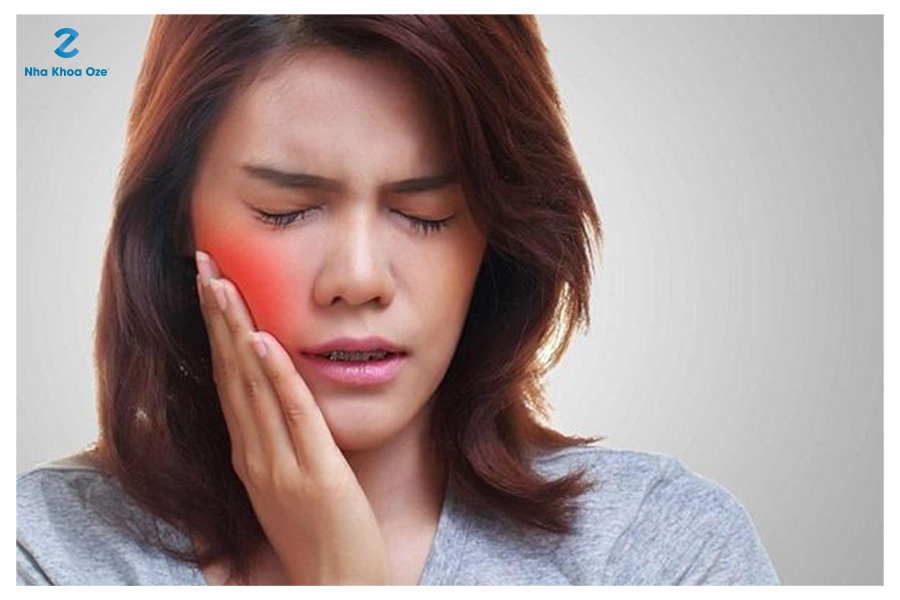 Răng khôn mọc lệch gây đau nhức khó chịu