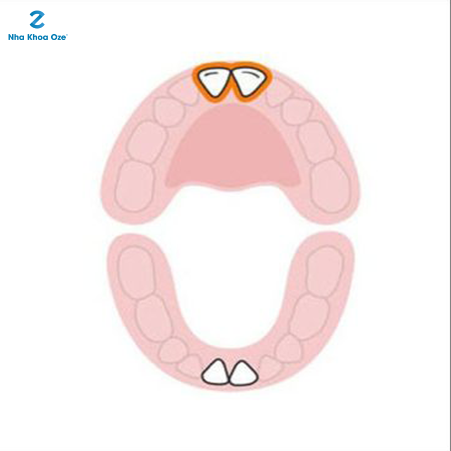 Kế đến là 2 chiếc răng cửa đối diện với 2 chiếc răng hàm dưới
