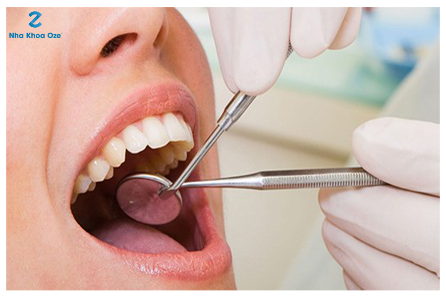 Việc lấy tủy răng để đảm bảo sức khỏe răng miệng