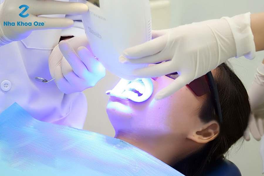 Tẩy trắng răng bằng Laser whitening tại Nha khoa Oze