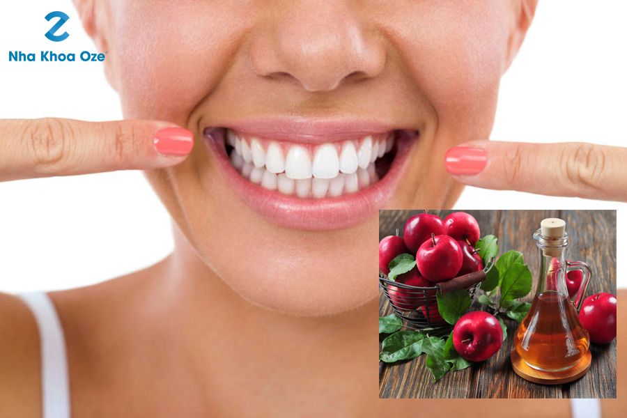 Sử dụng giấm táo để tẩy trắng răng