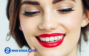 Đính đá vào răng có hại không? 4 điều cần biết về đính đá răng