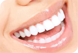 Bọc răng sứ được bao lâu? 4 yếu tố quyết định tuổi thọ răng sứ