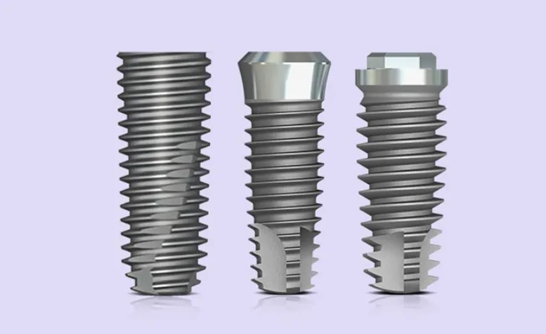 Cấy ghép răng Implant DIO của Hàn Quốc có thực sự tốt?