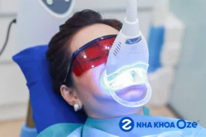 Tẩy trắng răng laser whitening và 5 vấn đề bạn cần biết