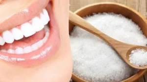 8 Cách làm trắng răng bằng muối đơn giản