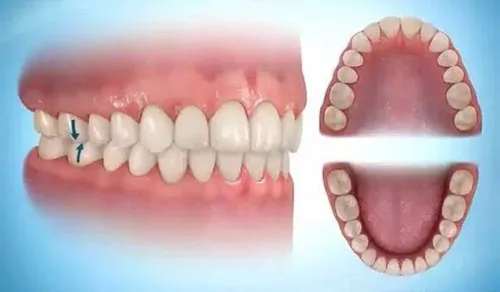 Tương quan hài hòa của răng 2 hàm