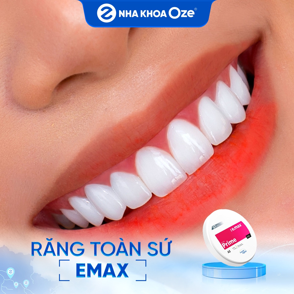 Khách hàng bọc răng sứ thẩm mỹ tại Nha khoa Oze