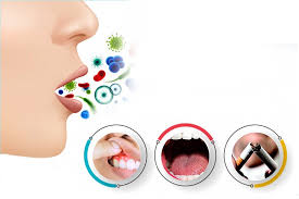Các nguyên nhân gây ra tình trạng hôi miệng