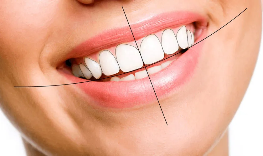 Khớp cắn chuẩn có trục đối xứng thẳng và không bị gãy