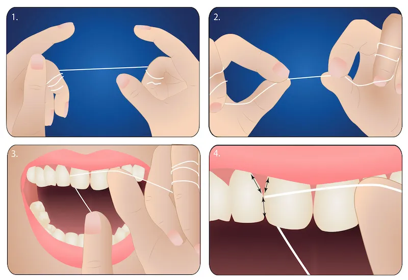 Hướng dẫn cách dùng chỉ nha khoa