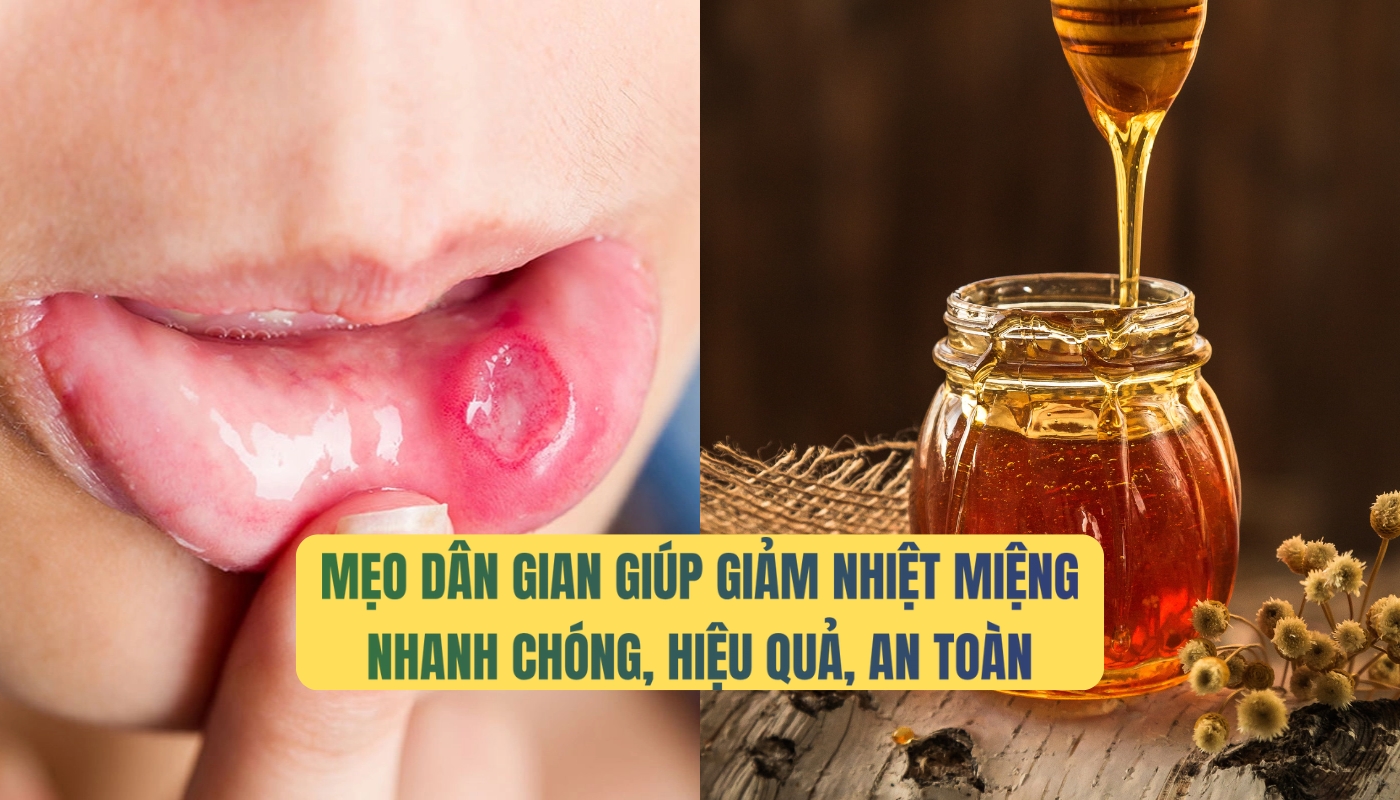 Mẹo dân gian giúp giảm nhiệt miệng