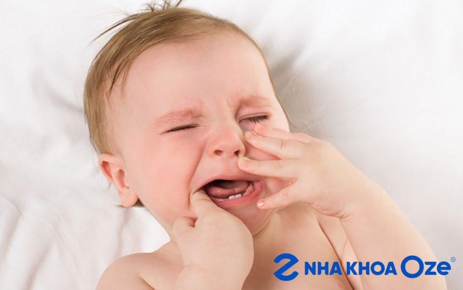 Giai đoạn mọc răng, gây sốt mọc răng là rất bình thường