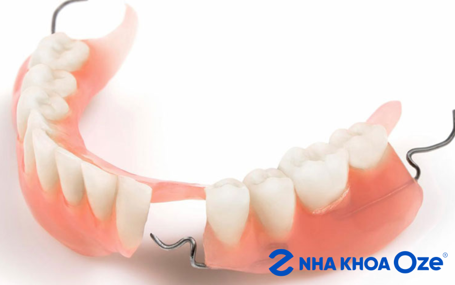 Hàm răng giả tháo lắp