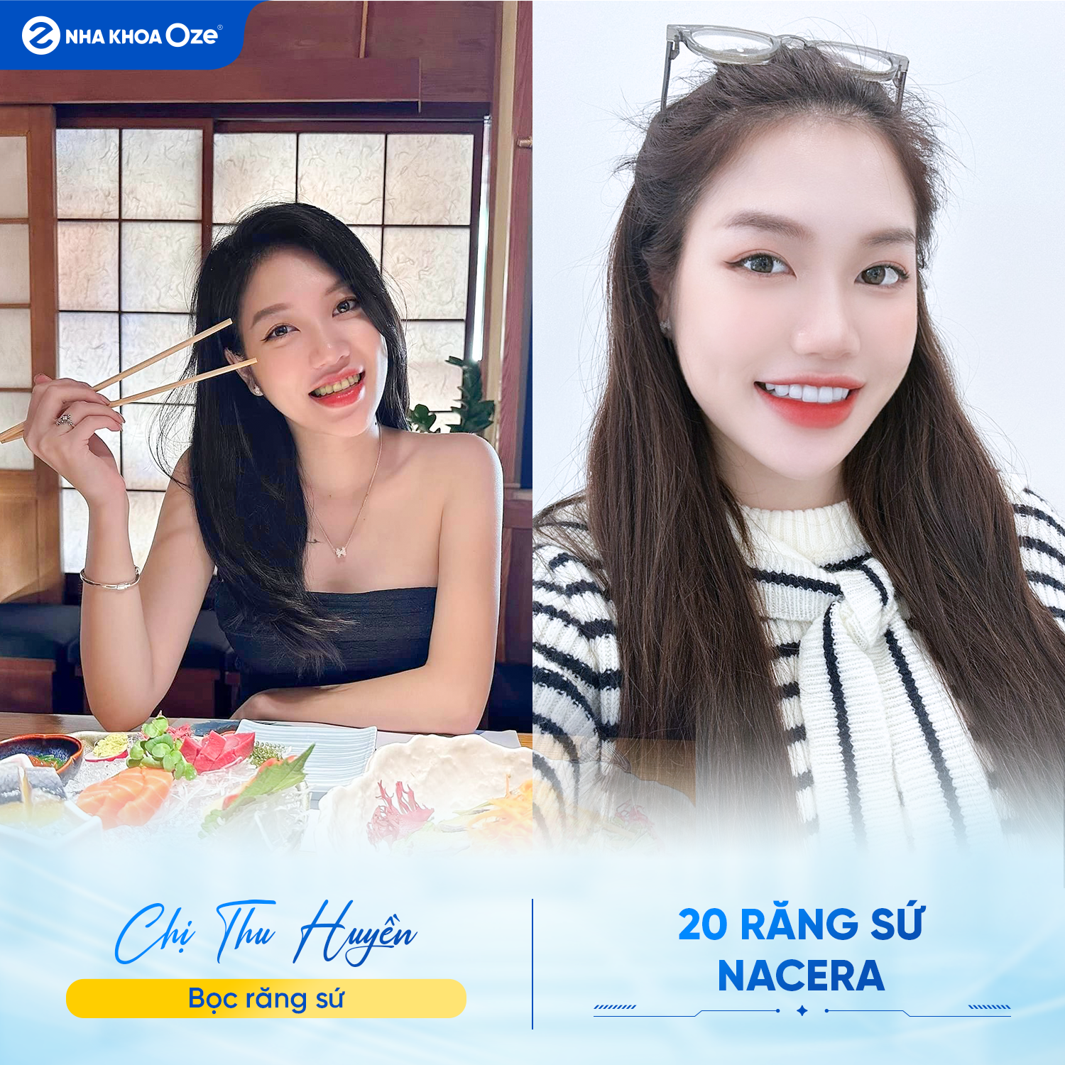 Khách hàng bọc răng sứ tại Nha khoa Oze đảm bảo hiệu quả tốt