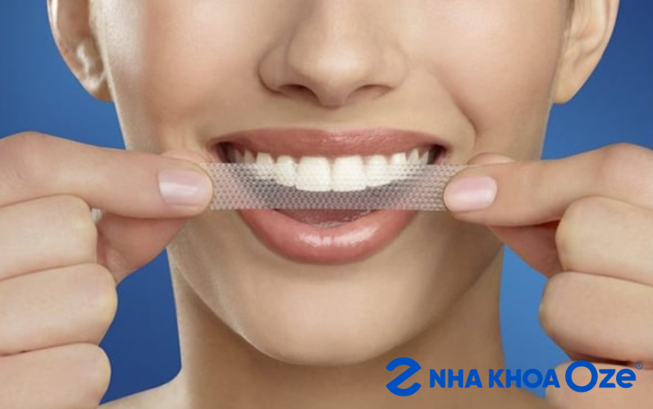 Miếng dán trắng răng