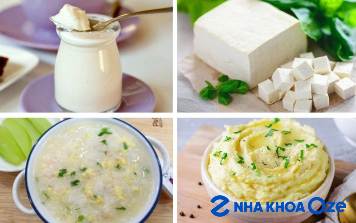 Nên ăn gì sau khi trám răng? Những thức ăn mềm là các món nên ăn