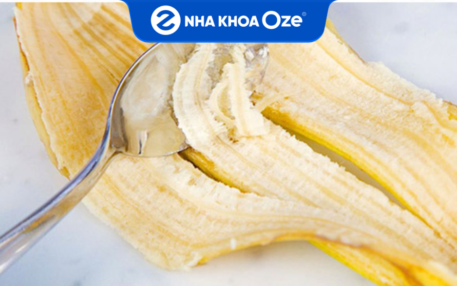 Vỏ chuối sẽ để lại nhựa trên răng nên sau khi sử dụng cần đánh răng với kem đánh răng để loại bỏ