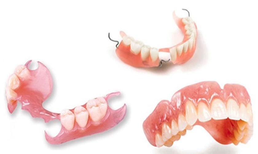 Trồng răng giả tháo lắp
