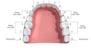Vị trí răng số 8 mọc ở đâu? Cách xử lý mọc răng khôn hiệu quả
