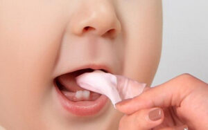 Bé bị nhiệt miệng nên ăn gì và kiêng gì để mau lành?