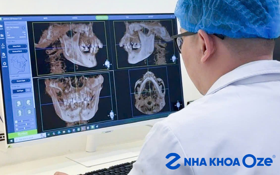 bác sĩ tư vấn niềng răng giá bao nhiêu tại Sóc Sơn