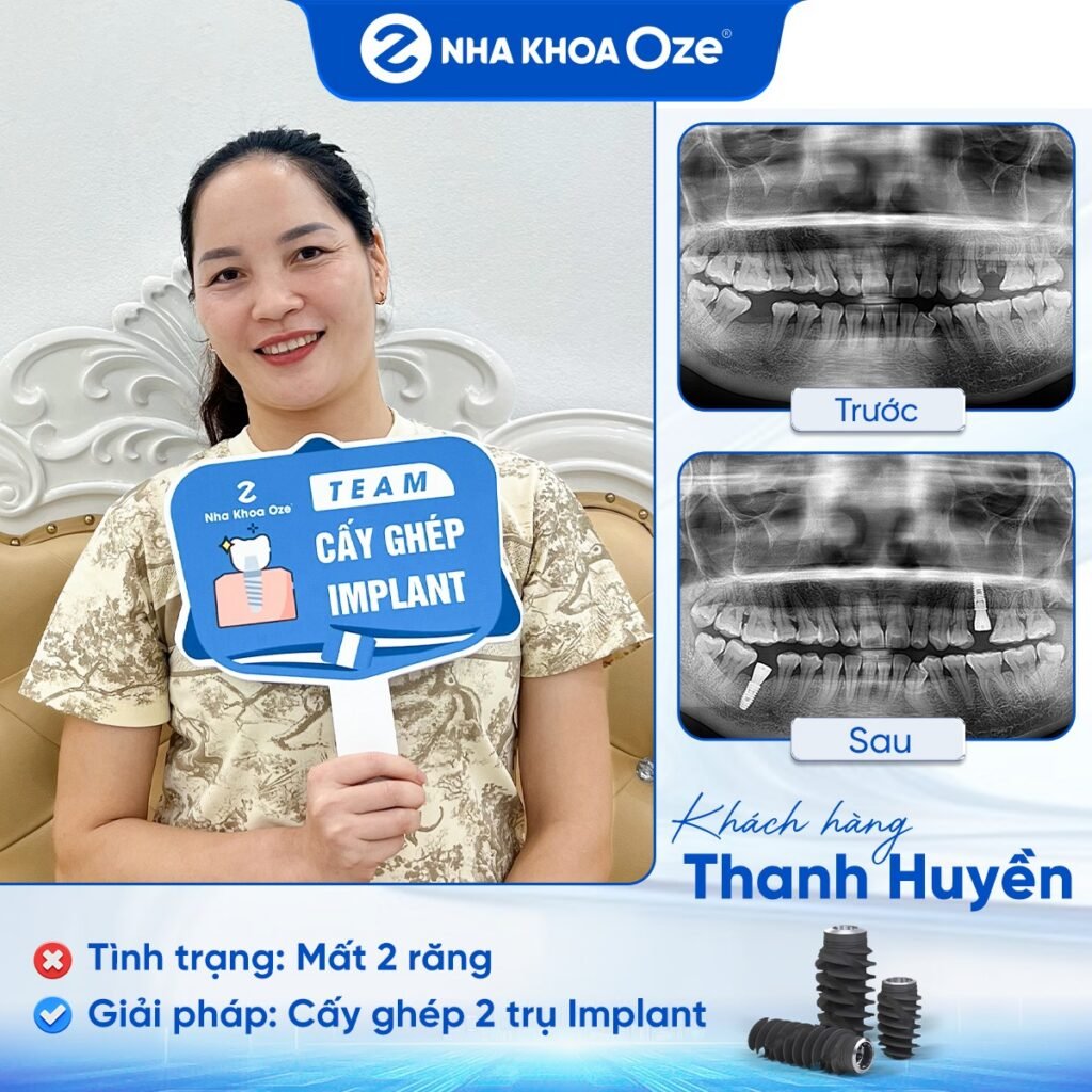Feedback Implant 2