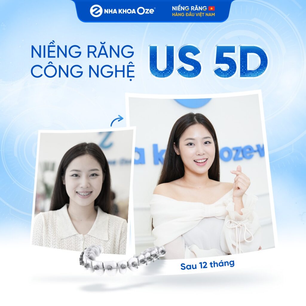 Feedback Niềng Răng 2