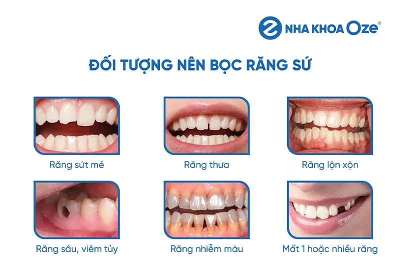 Feedback Răng Sứ 1