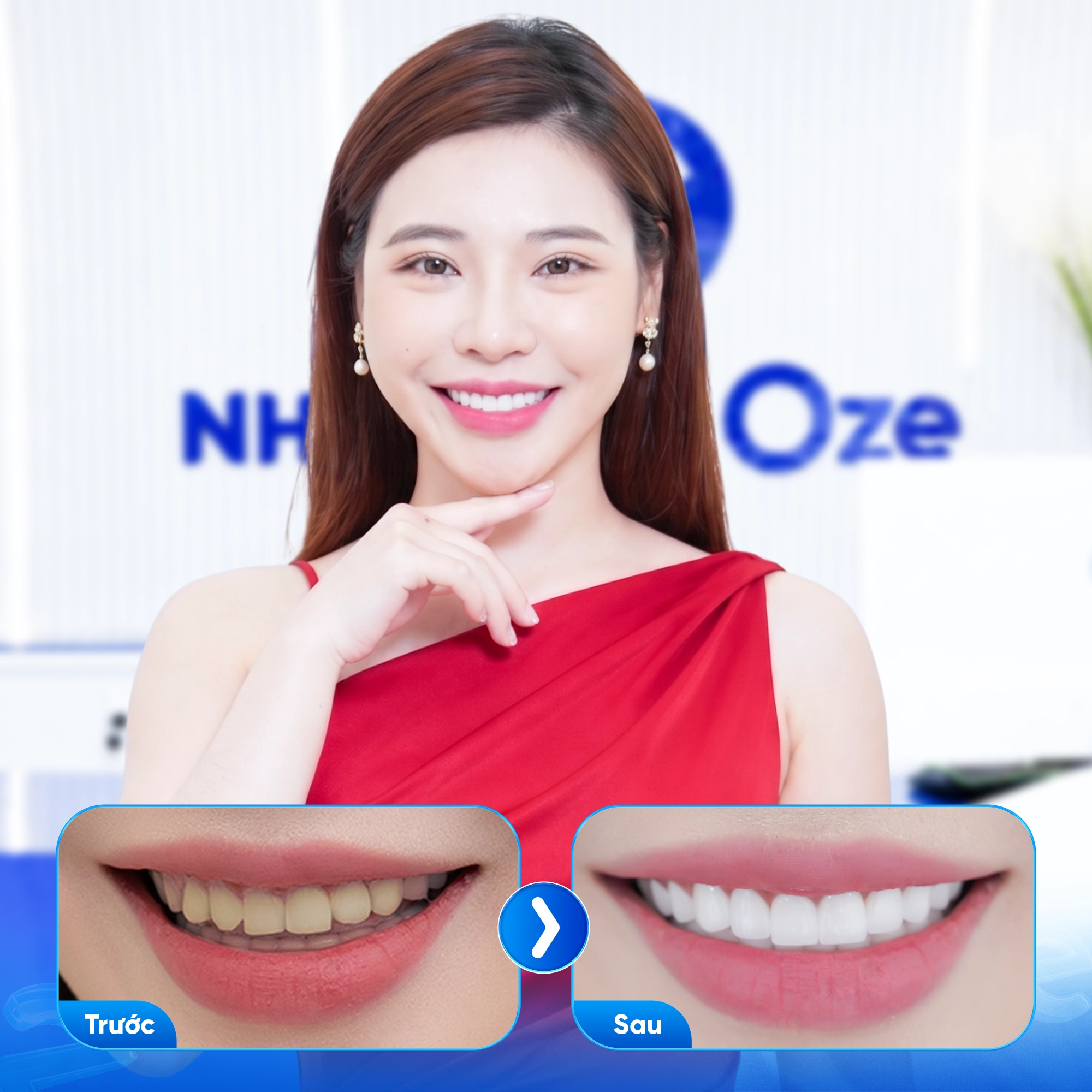 Khách hàng bọc răng sứ