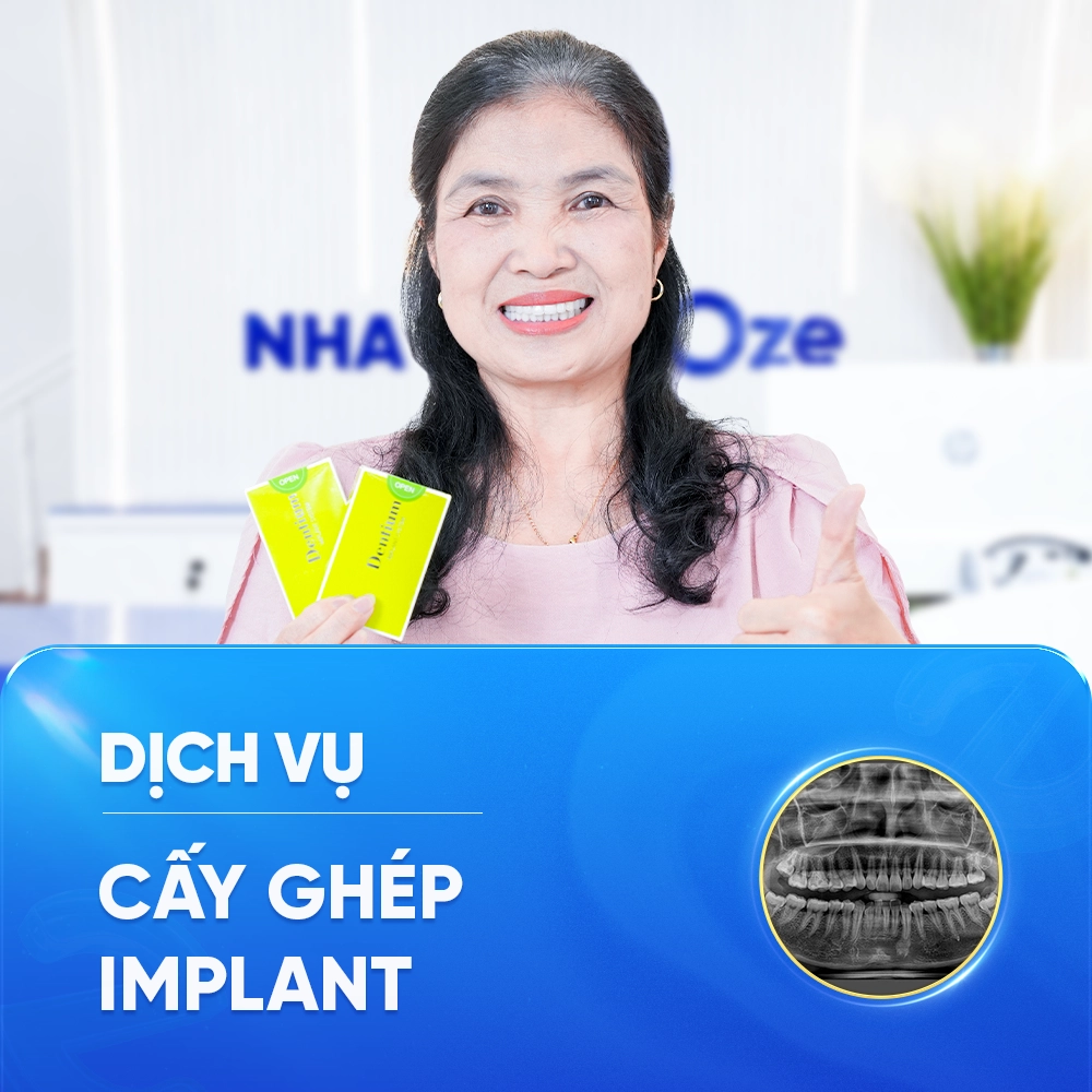 CẤY GHÉP IMPLANT