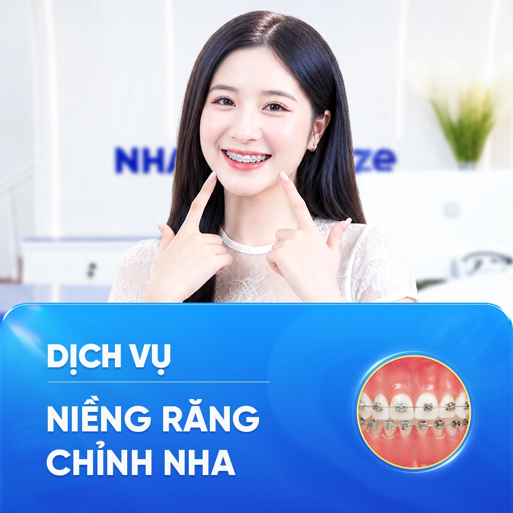 NIỀNG RĂNG - CHỈNH NHA