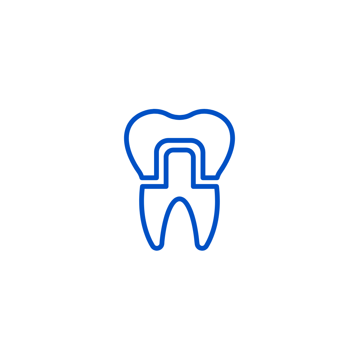 Tái khám và gắn mão sứ cố định trên Implant