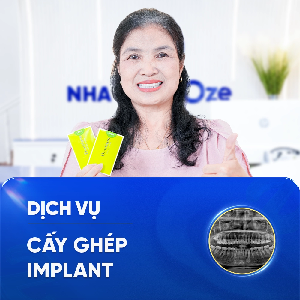 CẤY GHÉP IMPLANT