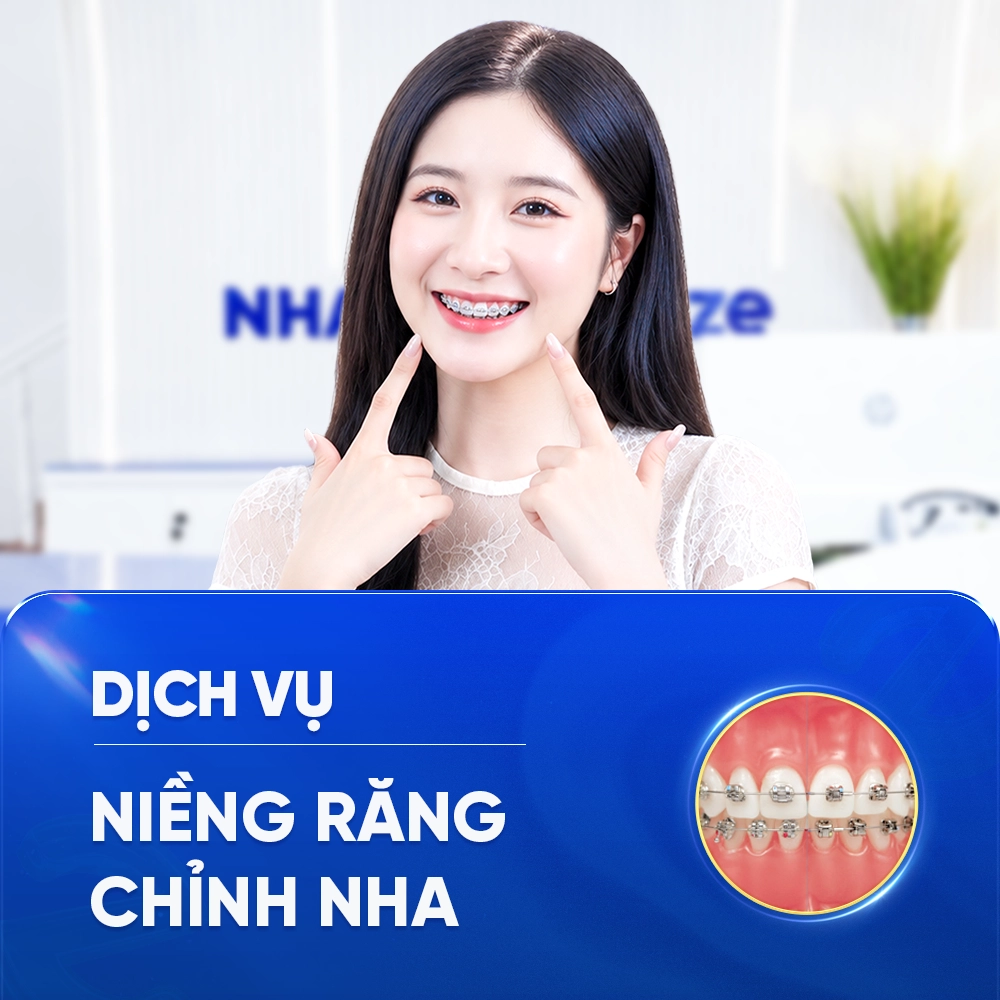 NIỀNG RĂNG - CHỈNH NHA