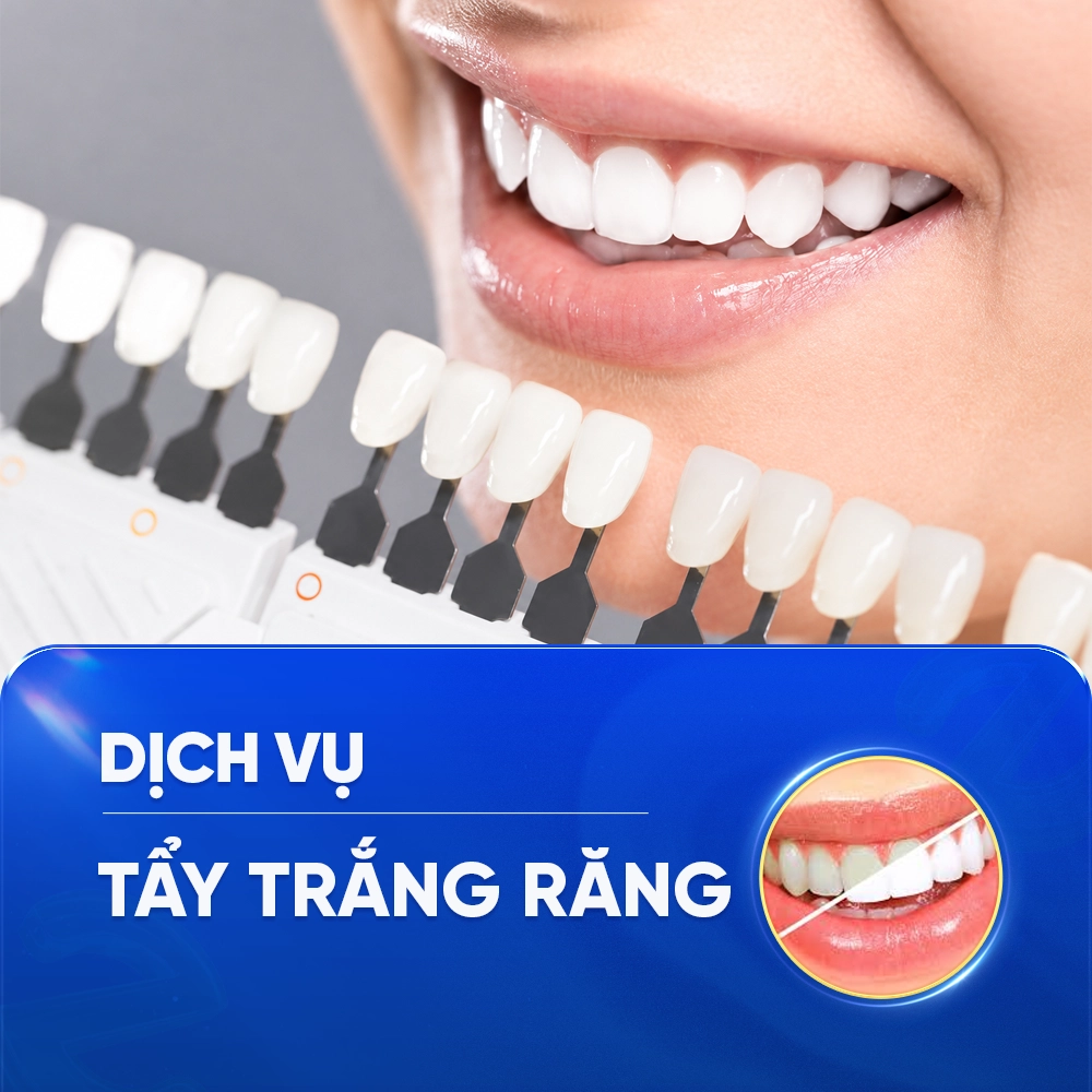 TẨY TRẮNG RĂNG