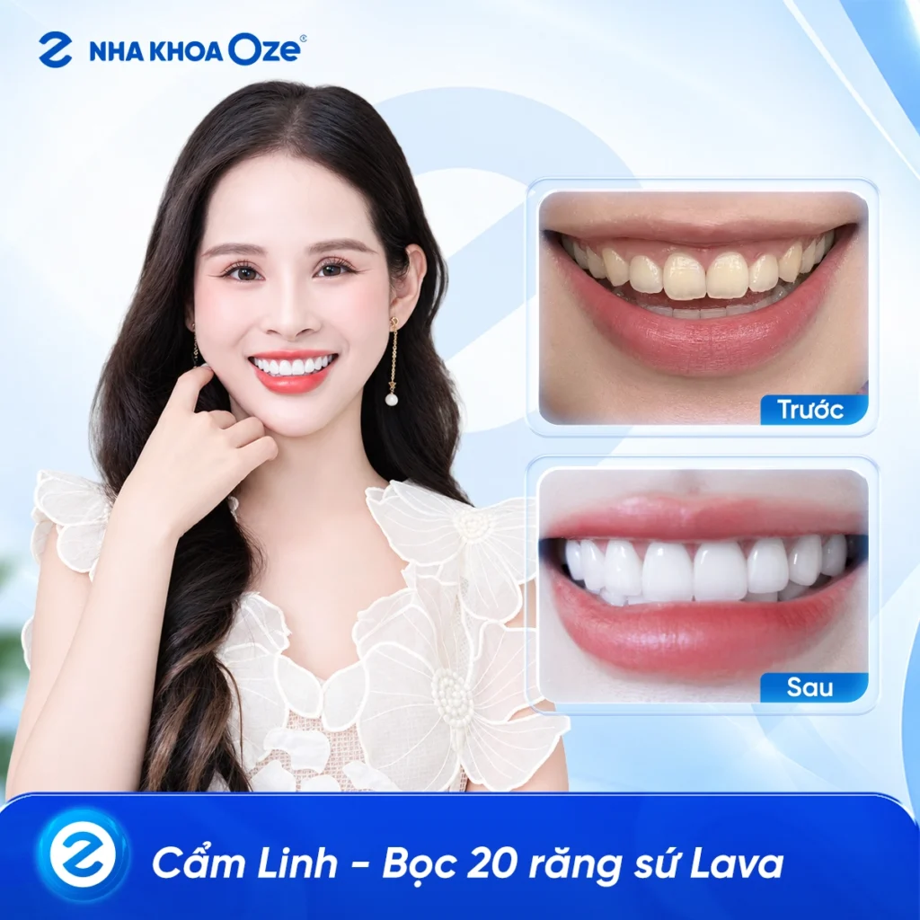 Feedback Răng Sứ 1