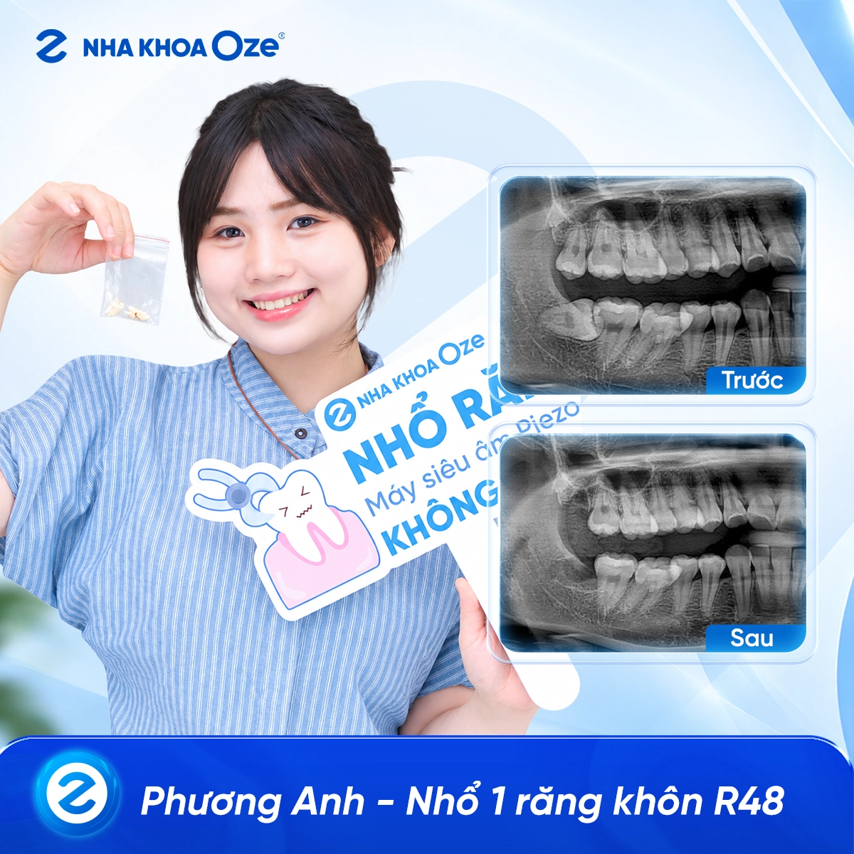 Khách hàng nhổ răng khôn