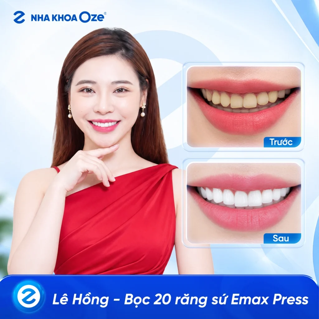 Feedback Răng Sứ 2