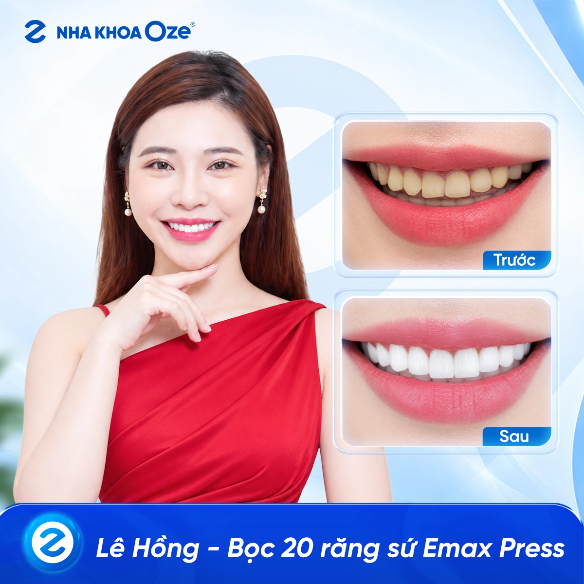 Khách hàng bọc răng sứ