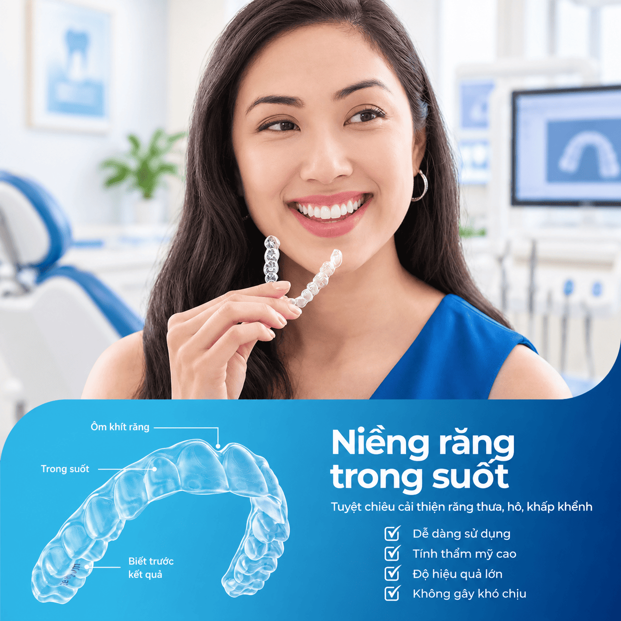 Ưu điểm vượt trội của niềng răng khay trong