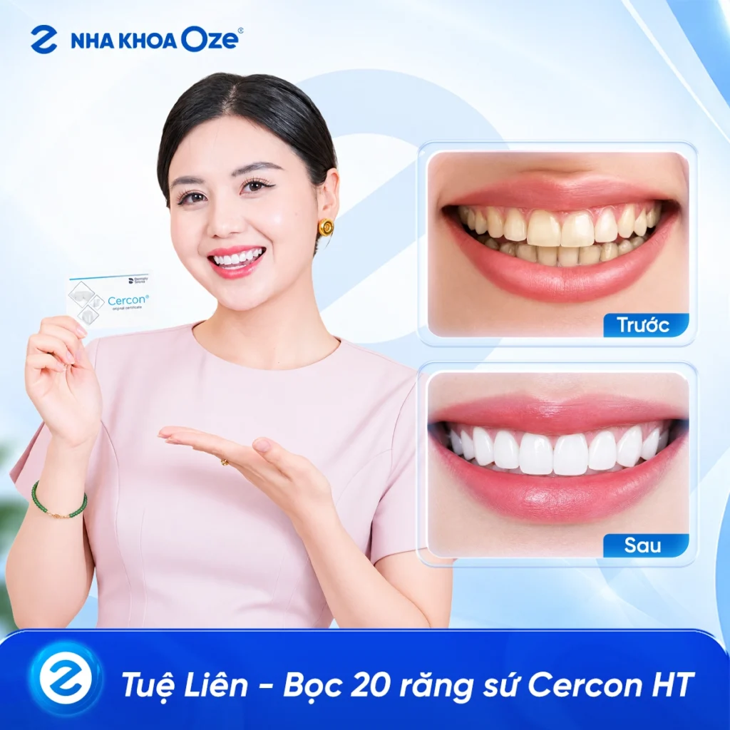 Feedback Răng Sứ 3
