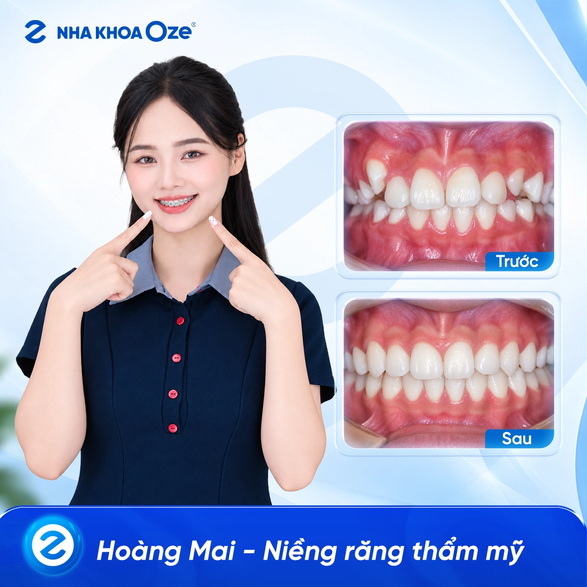 Khách hàng niềng răng