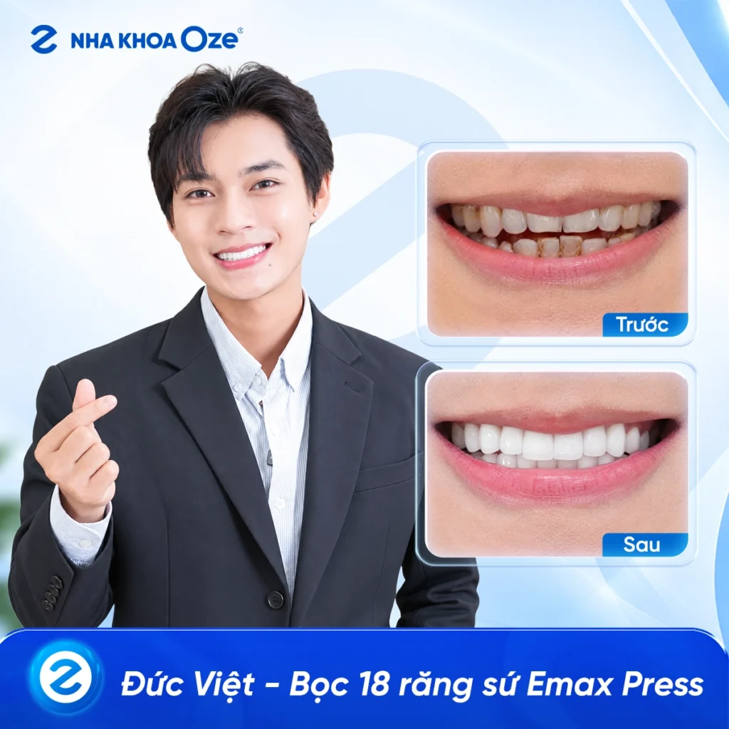 Feedback Răng Sứ 4