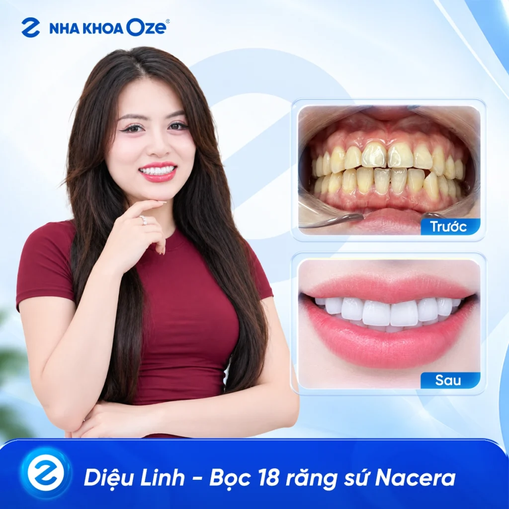 Feedback Răng Sứ 5